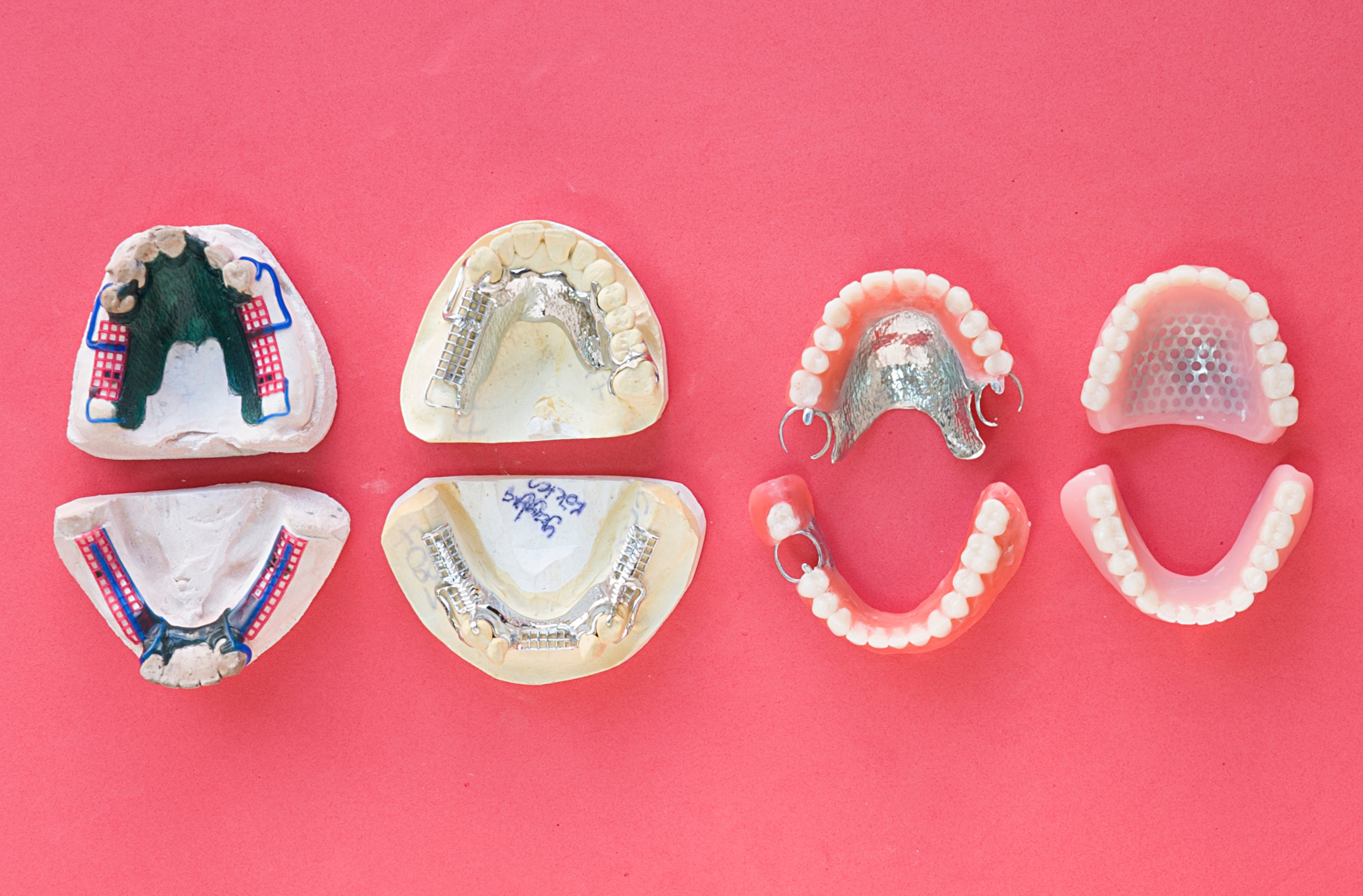 prosthodontik-meningkatkan-kualitas-hidup-melalui-gigi-palsu